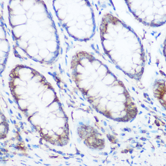 NOMO1 Antibody in Immunohistochemistry (Paraffin) (IHC (P))