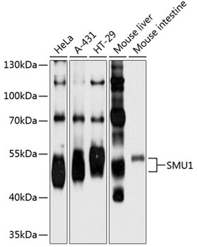 SMU1 Antibody in Western Blot (WB)