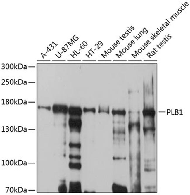 PLB1 Antibody in Western Blot (WB)