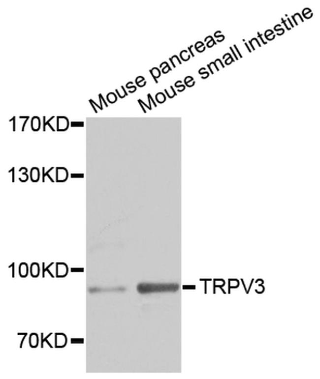 TRPV3 Antibody in Western Blot (WB)