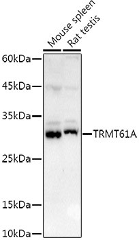 TRMT61A Antibody in Western Blot (WB)
