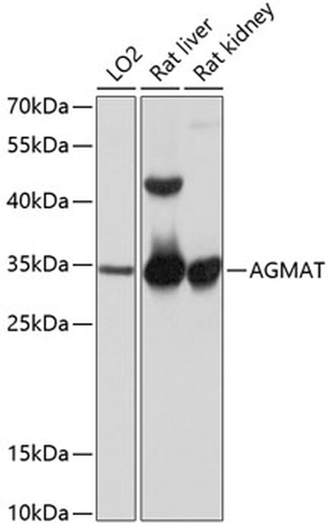 AGMAT Antibody in Western Blot (WB)