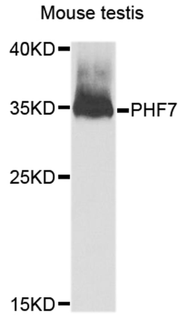 PHF7 Antibody in Western Blot (WB)