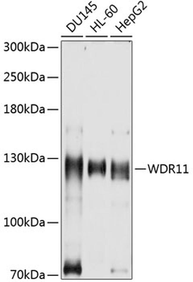 BRWD2 Antibody in Western Blot (WB)