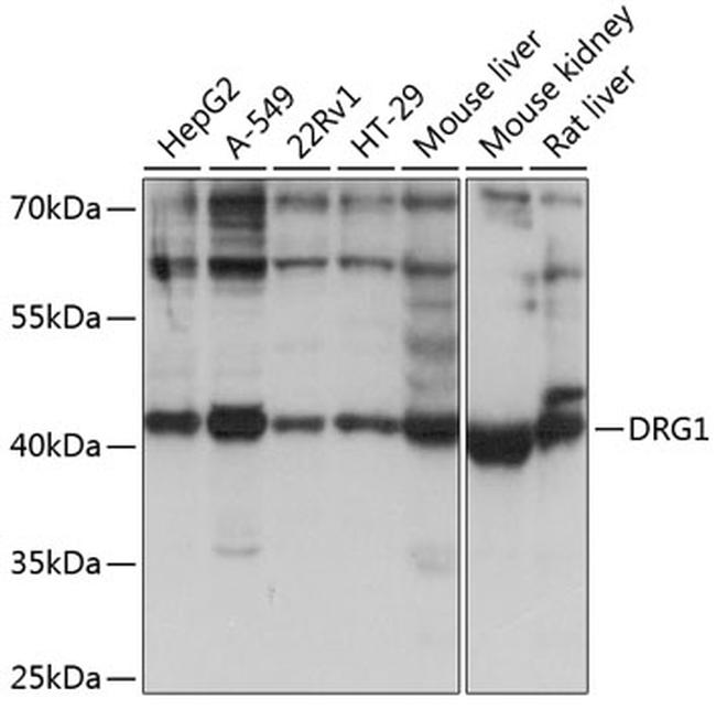 DRG1 Antibody in Western Blot (WB)