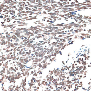 AQR Antibody in Immunohistochemistry (Paraffin) (IHC (P))