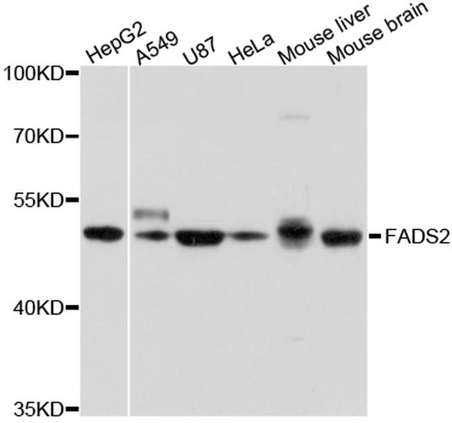 FADS2 Antibody in Western Blot (WB)
