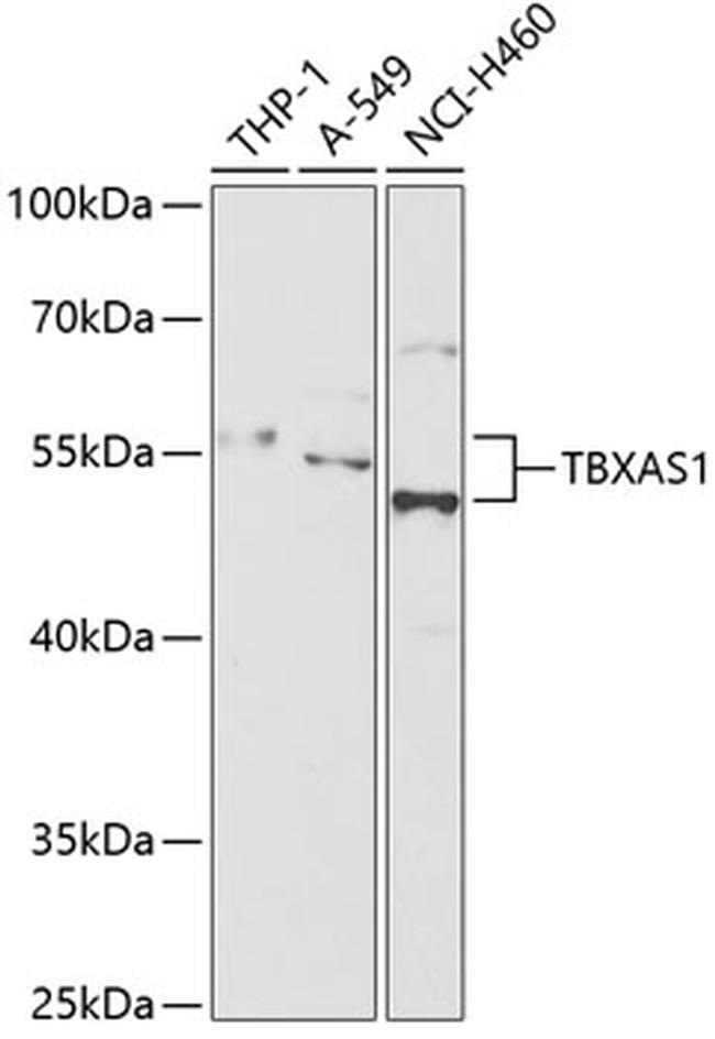 Thromboxane synthase Antibody in Western Blot (WB)