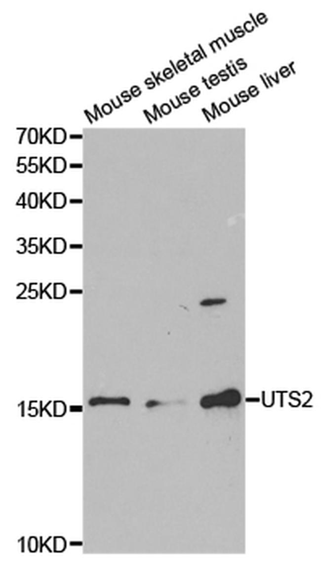 UTS2 Antibody in Western Blot (WB)