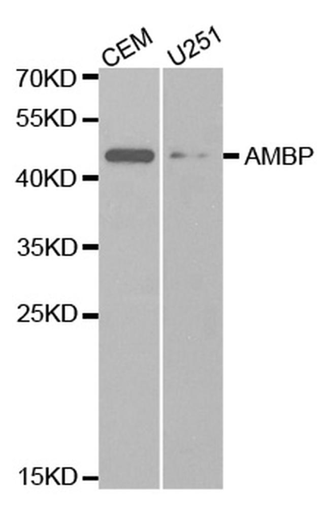 alpha-1 Microglobulin Antibody in Western Blot (WB)