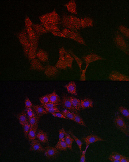 ANT Antibody in Immunocytochemistry (ICC/IF)
