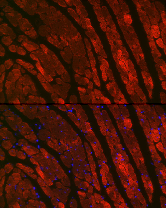Cardiac Troponin C Antibody in Immunocytochemistry (ICC/IF)