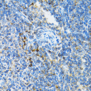 UBE2D1 Antibody in Immunohistochemistry (Paraffin) (IHC (P))
