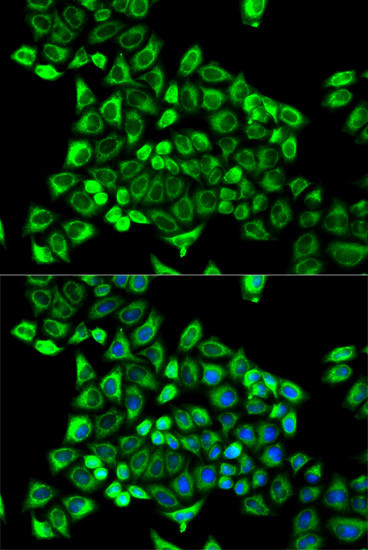 CDA Antibody in Immunocytochemistry (ICC/IF)