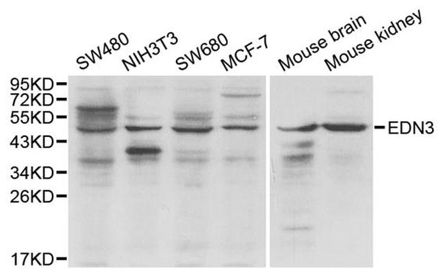 Endothelin 3 Antibody in Western Blot (WB)