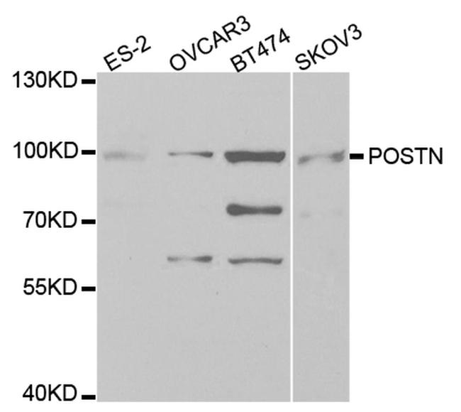 Periostin Antibody in Western Blot (WB)