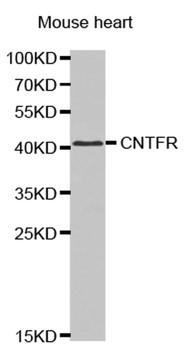 CNTFR Antibody in Western Blot (WB)