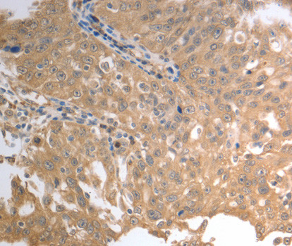 SLC1A4 Antibody in Immunohistochemistry (IHC)