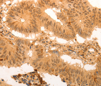 SUMO4 Antibody in Immunohistochemistry (Paraffin) (IHC (P))