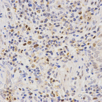 SCTR Antibody in Immunohistochemistry (Paraffin) (IHC (P))