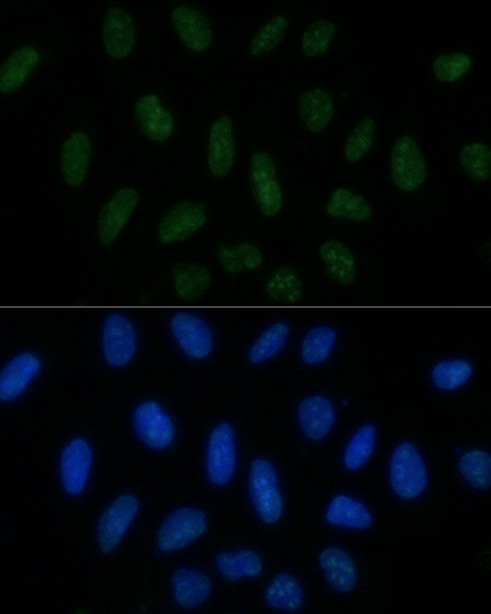 MNAR Antibody in Immunocytochemistry (ICC/IF)