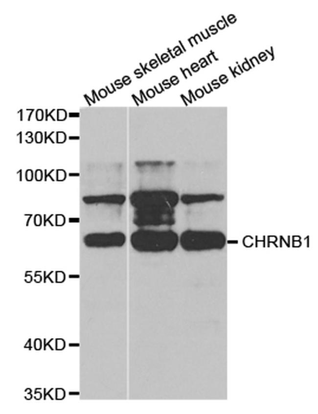 CHRNB1 Antibody in Western Blot (WB)