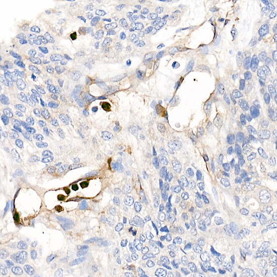 S100A12 Antibody in Immunohistochemistry (Paraffin) (IHC (P))