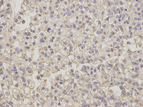 NEK2 Antibody in Immunohistochemistry (Paraffin) (IHC (P))