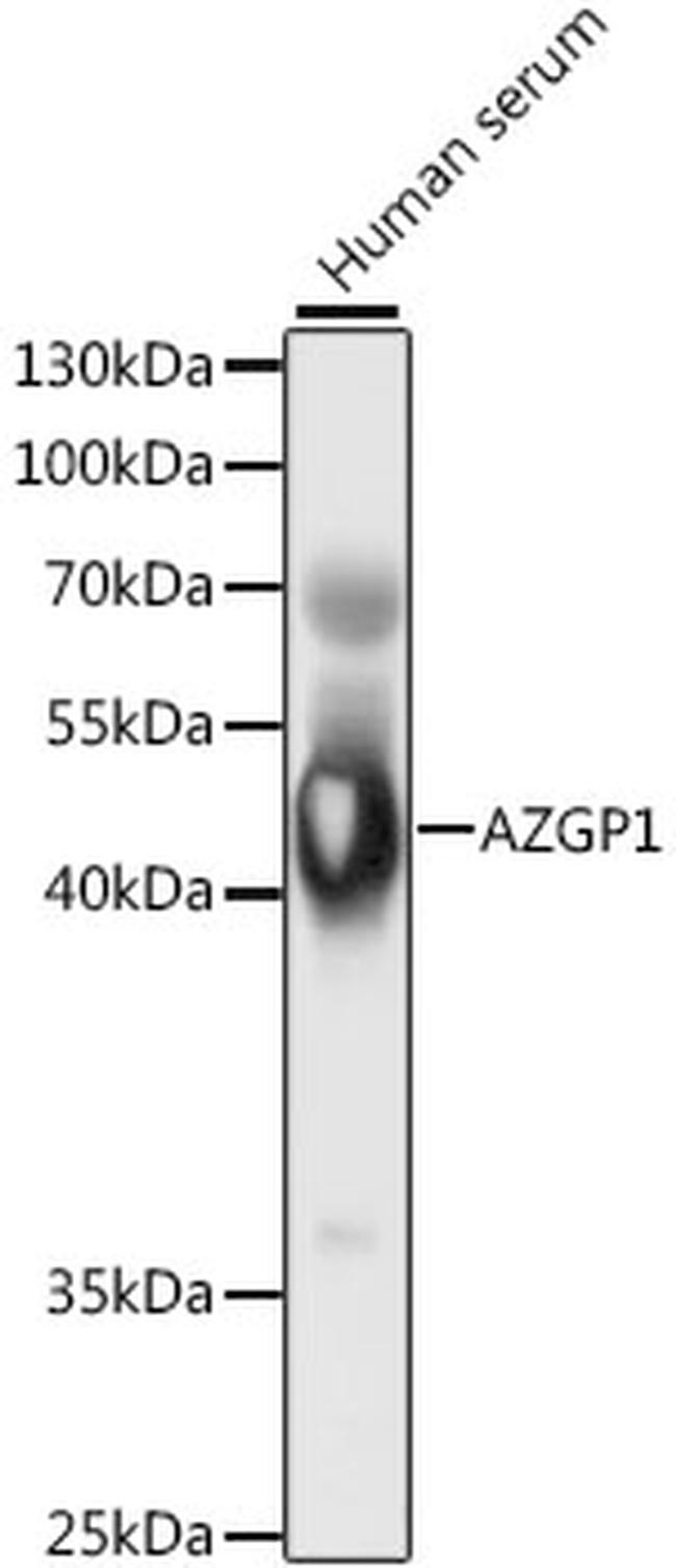AZGP1 Antibody in Western Blot (WB)
