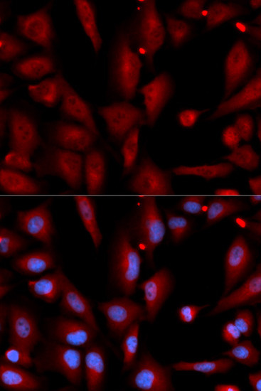 WIF1 Antibody in Immunocytochemistry (ICC/IF)