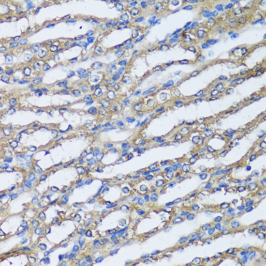 NQO2 Antibody in Immunohistochemistry (Paraffin) (IHC (P))