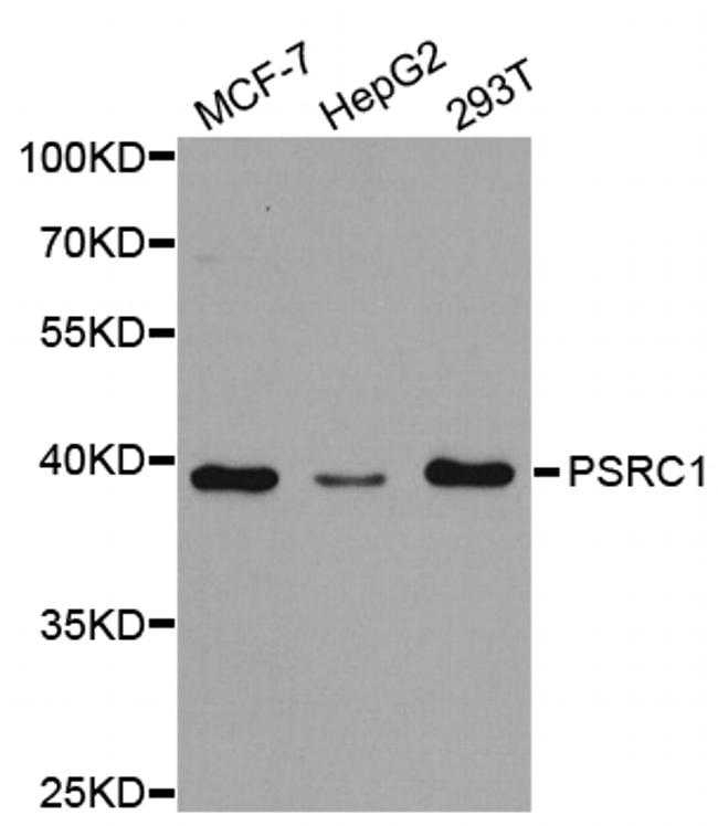 PSRC1 Antibody in Western Blot (WB)
