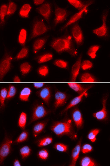 UROD Antibody in Immunocytochemistry (ICC/IF)