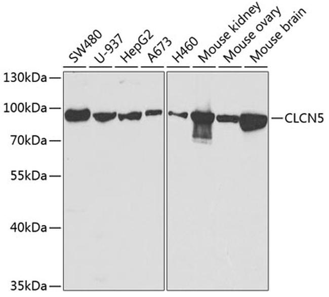 CLC-5 Antibody in Western Blot (WB)