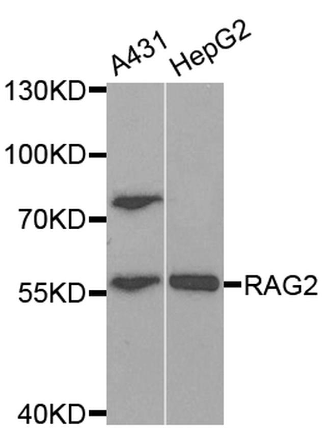 RAG2 Antibody in Western Blot (WB)
