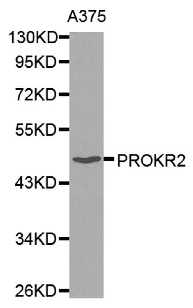 Prokineticin Receptor 2 Antibody in Western Blot (WB)