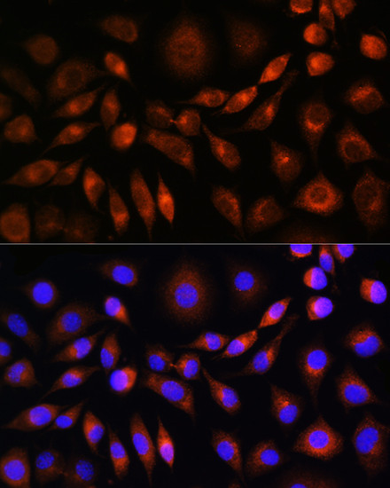 Apolipoprotein M Antibody in Immunocytochemistry (ICC/IF)