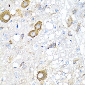 MGP Antibody in Immunohistochemistry (Paraffin) (IHC (P))