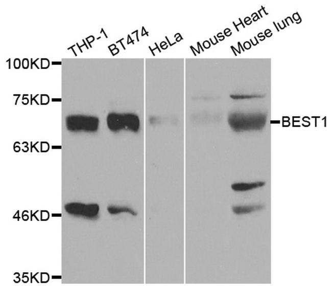 Bestrophin 1 Antibody in Western Blot (WB)