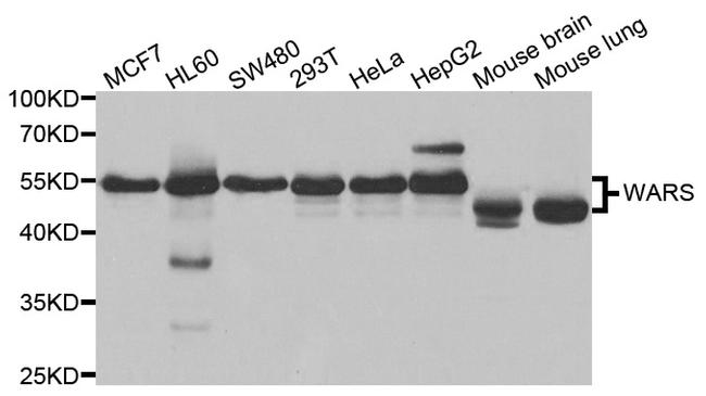 WARS Antibody in Western Blot (WB)