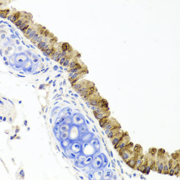 TOPBP1 Antibody in Immunohistochemistry (Paraffin) (IHC (P))