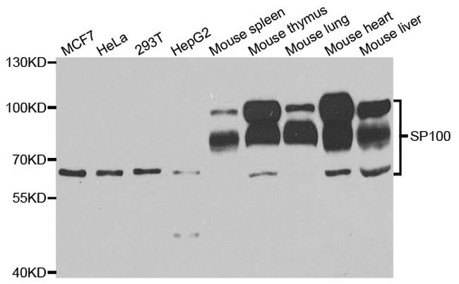 SP100 Antibody in Western Blot (WB)