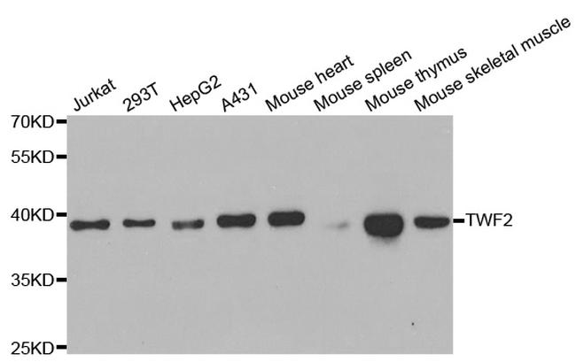 TWF2 Antibody in Western Blot (WB)