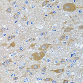 eIF2 gamma Antibody in Immunohistochemistry (Paraffin) (IHC (P))