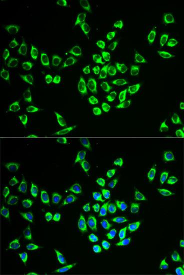 MRPL28 Antibody in Immunocytochemistry (ICC/IF)