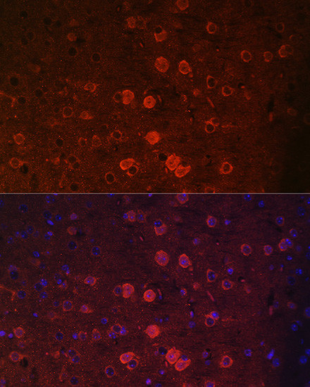 TRPM2 Antibody in Immunocytochemistry (ICC/IF)