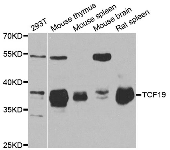 TCF19 Antibody in Western Blot (WB)