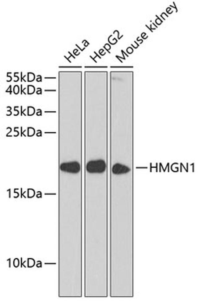 HMGN1 Antibody in Western Blot (WB)