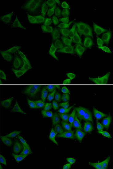 SMYD5 Antibody in Immunocytochemistry (ICC/IF)