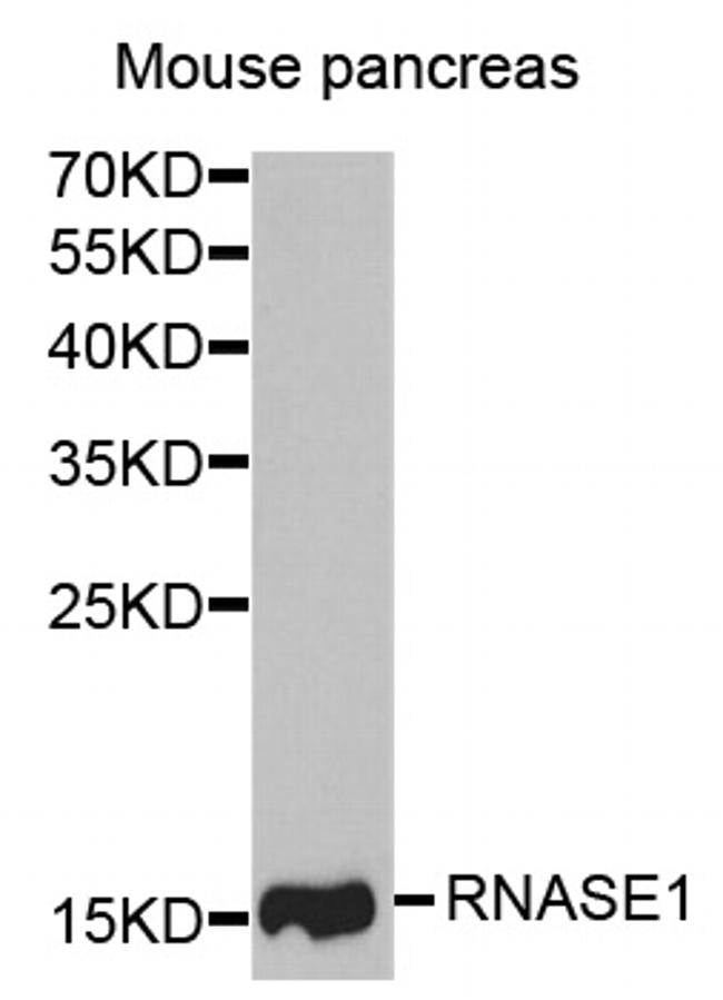 RNase1 Antibody in Western Blot (WB)
